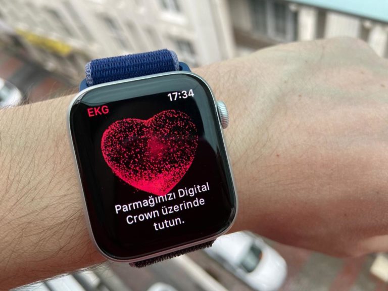 Apple Watch’ta EKG özelliği nasıl kullanılır?