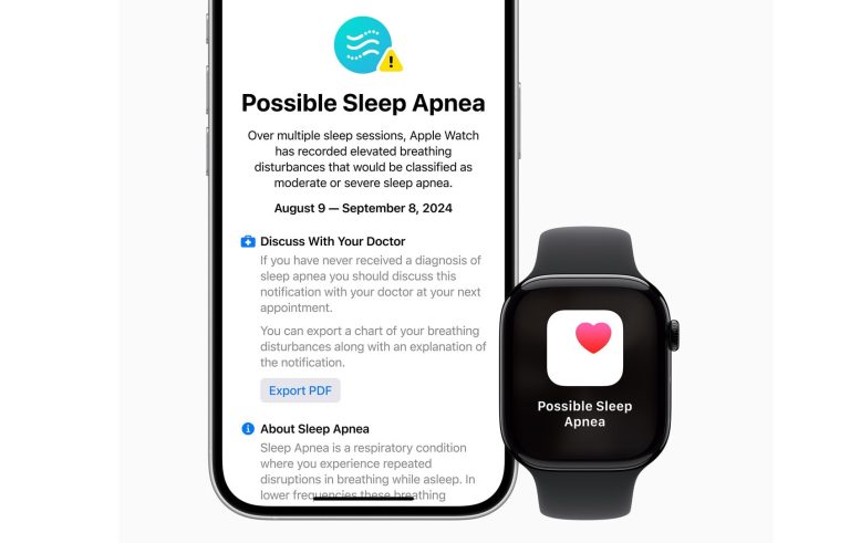 Apple Watch’a uyku apnesi bildirimleri geldi